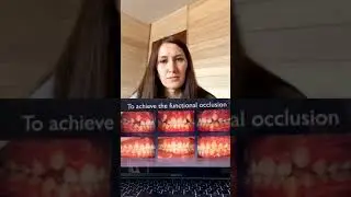 Лекция для докторов. Планирование ортодонтического лечения в рамках интердисциплинарной стоматологии