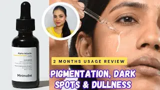 minimalist|alpha arbutin serum benefits|best serum for hyperpigmentation|dullness|dark spots|uneven