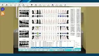 How to Create a Treatment Plan in Eaglesoft Autosaved