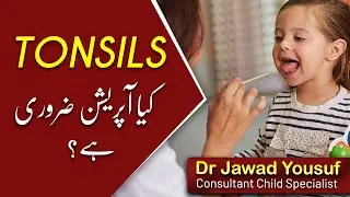 Tonsils || Urdu | Hindi || Healers Online
