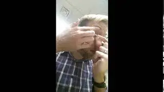 Scleral lens removal technique #1 from Mr Alex Petty, Bay Eye Care NZ
