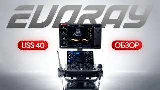 На что способен EVORAY USS 40? Большой обзор УЗИ аппарата