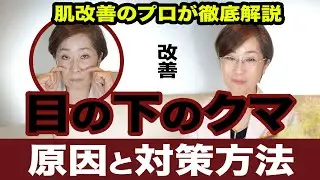 目の下のクマ 原因と対策方法