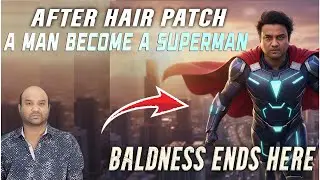 Hair Replacement for Men | Get a Full Head of Hair in Minutes | RK HAIR STUDIO