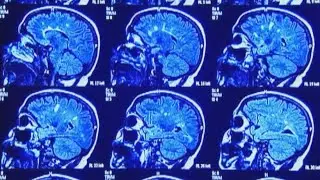 More heat means more headaches, here's how to avoid them