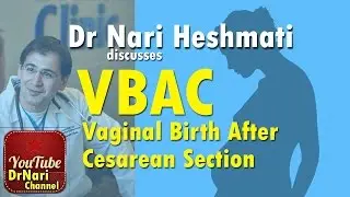 VBAC & TOLAC: Vaginal Birth After Cesarean Section Discussed by Dr Nari Heshmati