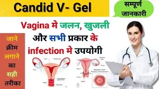 Correct use and benefits of Candid V gel | Candid cream | Candid B cream