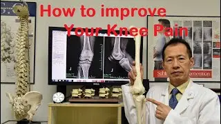 Japanese Style Acupuncture for Knee Pain Relief and Recover Quickly