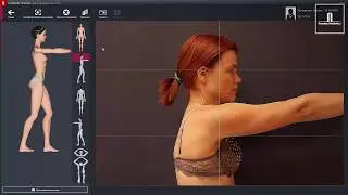 Как проходит картирование тела с использованием FotoFinder ATBM bodystudio