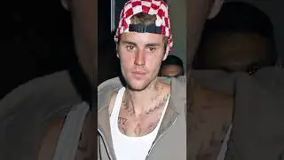 Fans Worried Over Justin Bieber's Recent Instagram Post