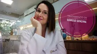 SORRISO GENGIVAL - COMO TRATAR? - DRA DANIELLE SALES