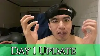 Day 1 Update | FUT/FUE Combo Hair Transplant | DHT Clinic (Bangkok)