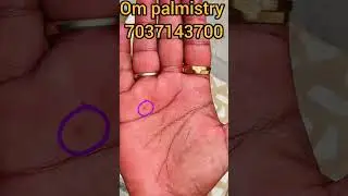 palm reading : black spot ka prabhav #hastrekha #astrology #palmistry