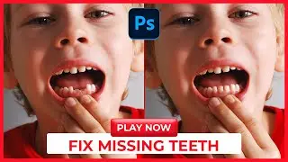fix missing teeth in photoshop #gfxtechniques #gfxt #shorts