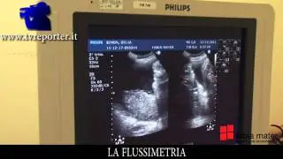 ECOGRAFIA: LA FLUSSIMETRIA