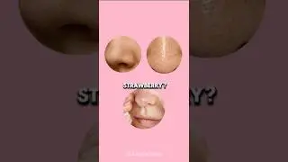 Strawberry nose? Not cute. 🍓👃#SkincareHacks #DoubleCleansing #GlassSkin #shorts #fyp #viral