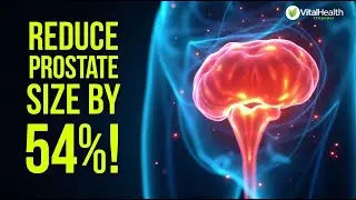 What Happens to Your Prostate Health When You Eliminate These 9 Common Foods?