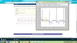 plot ecg database in matlab