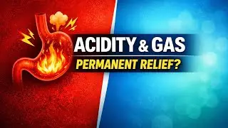 Gas & Acidity Ka Permanent Ilaj | Homeopathy vs Allopathy Truth