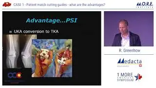 Patient match cutting guides &ndash; what are the advantages - Dr. Greenhow