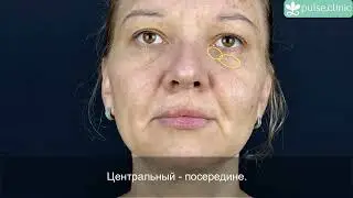 6. Юлия. Подробный разбор проблем в области лица и шеи. Пластический хирург В.Козлов (Архангельск)