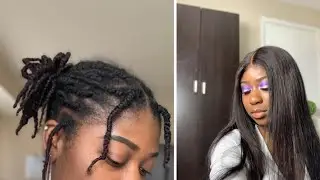 How To Install A Wig Over Starter Locs