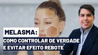 MELASMA: COMO CONTROLAR DE VERDADE E EVITAR O EFEITO REBOTE