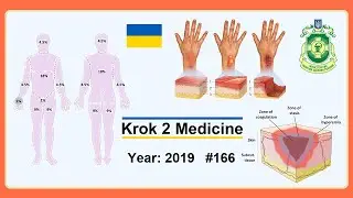 [ Krok 2 Medicine ] Year: 2019 - 166 (Ministry of Public Health of Ukraine)