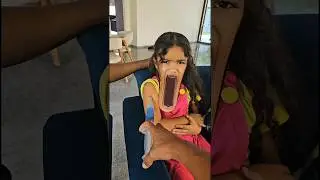 Soft mouth😱😢😭⚠️ #funny #comedy #funnyvideo #memes #family #funnymoments #viralvideo #video #shorts