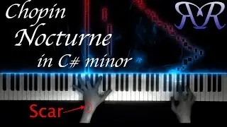 F. Chopin - Nocturne op. posth. n&deg;20 in C# minor