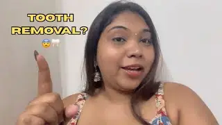 Tooth Removal 🦷 😨 | Random Vlog