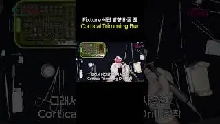 Fixture 식립 방향 바꿀 땐 Cortical Trimming Bur #dr_teddy_regeneration_institute