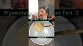 Pigmentation Treatment at Home #brightskin #skincare #pigmentation #pigmentationsolution #shortvideo