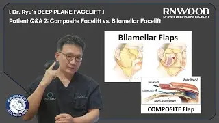 Patient Q&A 2: Composite Facelift vs. Bilamellar Facelift  [ Dr. Ryu's DEEP PLANE FACELIFT ]