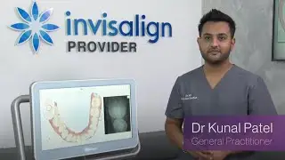 Dr. Kunal Patel on how iTero™ intraoral scanner has impacted his practice