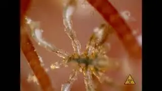 Anoplodactylus (sea spider)