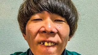 【大事件】ニートの歯が無くなりました