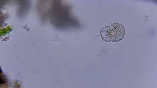 The ciliate Urocentrum turbo, spinning