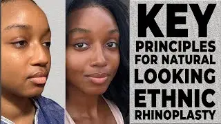 Key Principles for Natural-Looking Ethnic Rhinoplasty | Dr. Bora Ok Explains