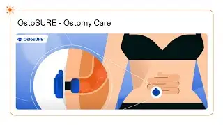 OstoSURE: Revolutionizing Ostomy Care with Bagless Freedom | Life Science Animation
