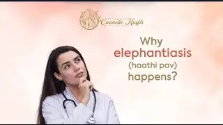 Why Does Elephantiasis (Haathi Pav) Happen/ Filariasis filaria Kyu Hota Hai? Raipur Dr neeraj pandey