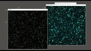 Counting, Density, and Intensity Measurement Using ImageJ