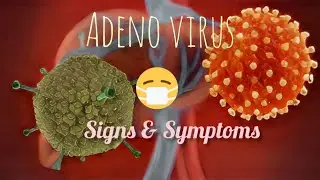 How do you get rid of Adeno virus naturally?
