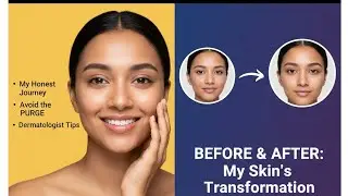 How to Use Tretinoin creamLike a Pro (Clear Skin Without the Peeling)#tretinoincream#clearskin#viral