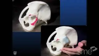 Building Evidence for 3D Printing in Medicine CLINICAL Perspective: Implants