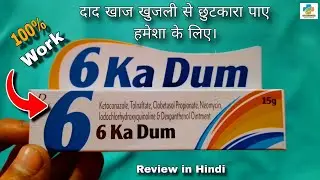 6 ka Dum Cream Review in Hindi | Fungal infection | Ringworm | iching |6Ka Dum ointment| SK MEDICINE