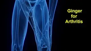 Can Ginger and Ginger oil help people with Arthritis ( joint pain)? try these 6 uses .
