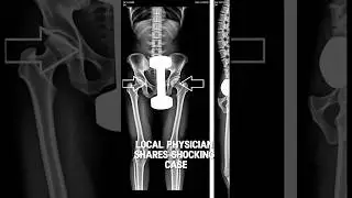 Shocking Medical Case.. #shortvideo #news #shorts