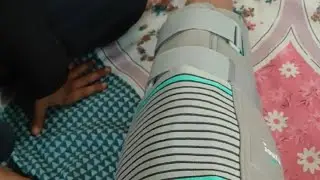 Exercise After Surgery Proximal Tibia Left Side Frectur @AshTradingPassion #surgeryrecovery