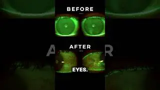 What 24 Hours Of Screen Time Does To Your Eyes!